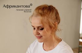 Безопасная терапия акне при аутоиммунных заболеваниях: научно обоснованный подход Метода Африкантовой®
